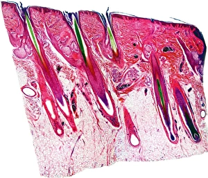 Epidermis And Dermis Layers Imprime: Skin section, light micrograph