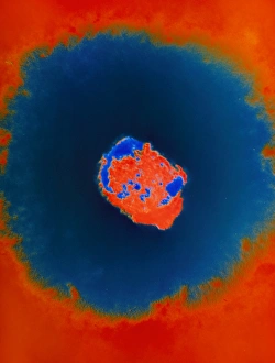 Smallpox Virus Imprime: Smallpox virus