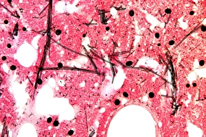 Imágenes de noviembre de 2008: Técnica de tejido esponjoso, micrografía ligera