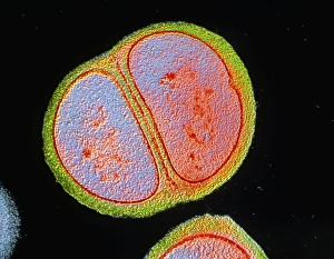 Transmission Electron Microscopy Images Imprime: Staphylococcus epidermidis bacterium