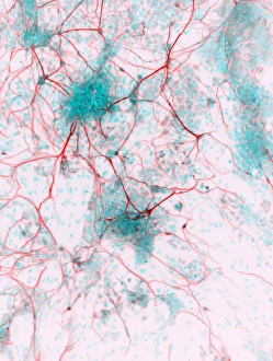 Impresiones de Células madre derivadas de neuronas. Micrografía con luz de humanos células nerviosas (neuronas) que han sido derivadas desde celdulas pluriplenipotenciales inducidas (IPS) Imágenes fechadas en diciembre de 2012: Células madre derivadas de neuronas, micrografía