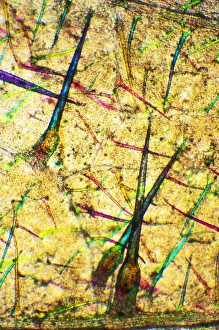 Stinging Nettle Leaf Imprime: Stinging nettle leaf, light micrograph