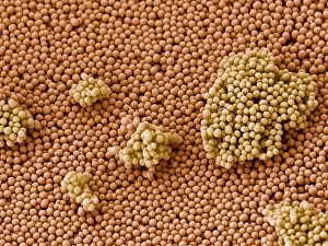 SEM Images Of Bacteria Imprime: Streptococcus bacteria, SEM