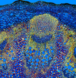 Vascular Bundle Structure Imprime: Sunflower stem, light micrograph