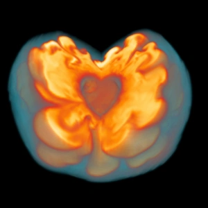 Impresión enmarcada : Explosión de supernovas Impresión enmarcada : Explosión de supernovas