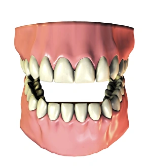 Imágenes de agosto de 2006: Encías y gomas dentarias