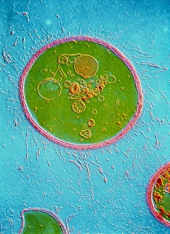 Imágenes de 1988: Cifra de Cryptococcus neoformans