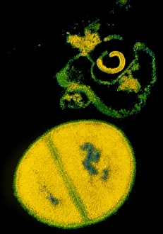 Antibiotic Resistant Bacteria Imprime: TEM Staphylococcus aureus