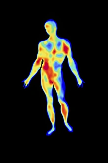 Thermography Images Imprime: Thermogram