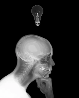 Rayos X Imprime: Hombre pensante con una bombilla de luz