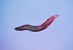 Intestinal Parasites Imprime: Threadworm, light micrograph