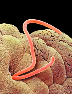 Scanning Electron Micrograph SEM Images Imprime: Threadworms in the gut, SEM