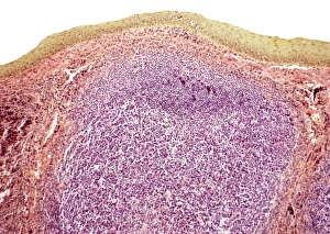 Immune System Cells Imprime: Tonsil, light micrograph