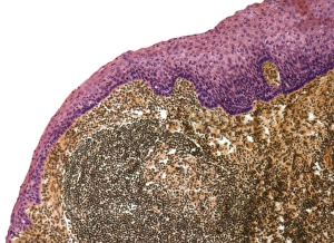 Light Microscopy Images Imprime: Tonsil, light micrograph F006 / 9818
