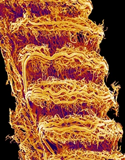 Impresiones de La tráquea. Micrografía de escaneo electrónico colorida (SEM) del exterior de la tráquea (trígula o tubo respiratorio). La tráquea une el laringeo con los pulmones Imágenes fechadas el 9 de septiembre de 2004: Trachea