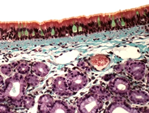 Respiratory System Anatomy Imprime: Trachea, light micrograph