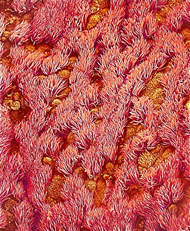 Respiratory Tract Anatomy Imprime: Trachea, SEM