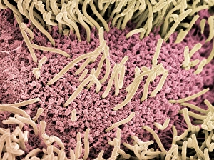 Impresiones de El escarabajo. Micrografia de microscopio electrónico colorido (SEM) del lado inferior de un caracol (orden Gastropoda) Imágenes fechadas en enero de 2005: Bajo de un escarabajo, SEM