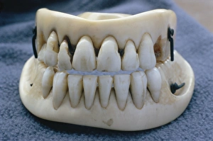 Imágenes de noviembre de 2003: Dientes falsos de Waterloo