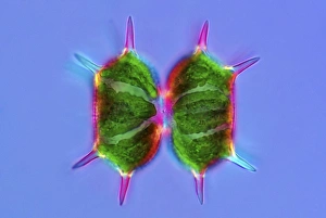 Polarised Light Microscopy Imprime: Xanthidium desmids, light micrograph