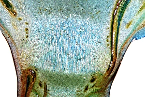 Estembajo joven, micrografía de luz fina