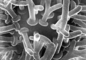 Electron Microscope Images Imprime: Synaptic Knobs First Photographed