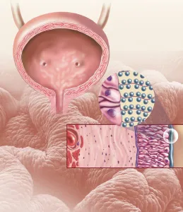 Female Reproductive System Anatomy Imprime: Detail of the cellular structure that forms the bladder lining