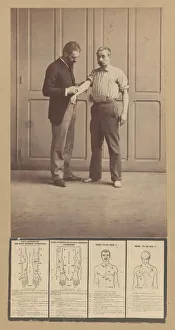 Alphonse Bertillon Imprime: Notation of Scars, Schematic Drawings, ca. 1893. Creator: Alphonse Bertillon