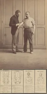 Notación de Cicatrices, Dibujos Esquemáticos, ca. 1893. ca. 1893. Creador: Alphonse Bertillon