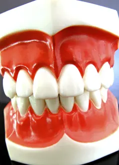Dental Prosthesis Imprime: False teeth