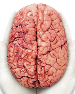 Brain Anatomy Imprime: Human brain