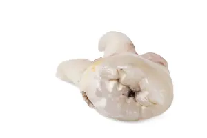 Bright Light Photography Imprime: Pulled wisdom tooth, tooth, carious