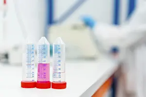 Healthcare Professionals At Work Imprime: Three tubes with samples in the table of a laboratory with someone working on the background