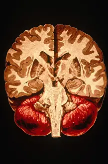 Human Brain Anatomy Imprime: Brain, Coronal Section