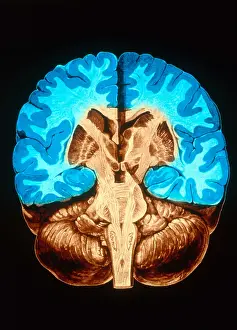 Human Brain Anatomy Imprime: Brain, Coronal Section
