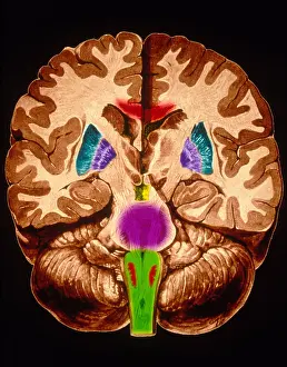 Human Nervous System Imprime: Brain, Coronal Section