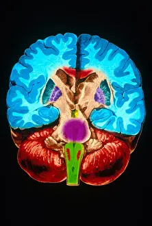 Cerebral Cortex Illustration Imprime: Brain, Coronal Section