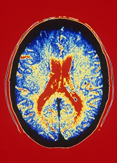 Human Brain Anatomy Imprime: Brain, CT Scan