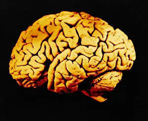Human Body Systems Imprime: Human Brain