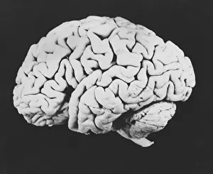 Central Nervous System Diagram Imprime: Human brain