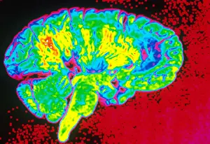 Human Brain Anatomy Imprime: Human Brain