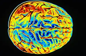 Nervous System Diagrams Imprime: Human Brain