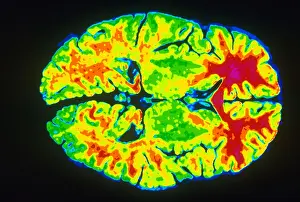 Magnetic Resonance Imaging Imprime: Human Brain