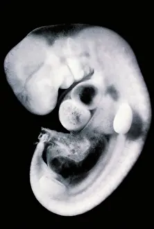 Scanning Electron Microscope Images Imprime: Human embryo