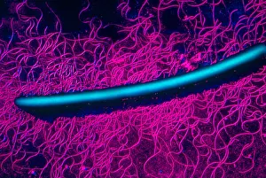 TEM Micrograph Imprime: Proteus