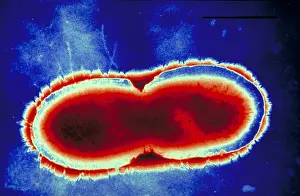Electron Microscopy Images Imprime: Pseudomonas cepacea