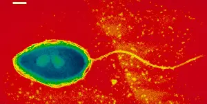 Electron Microscopy Images Imprime: Pseudomonas cepacea