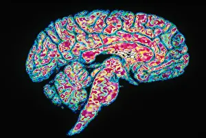Human Nervous System Imprime: Sagittal Section of Brain