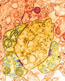 Transmission Electron Microscopy (TEM) Imprime: Synapse, TEM